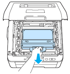 Remove Waster Toner Pack 2