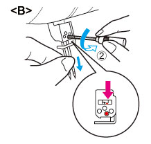 Removing the right needle