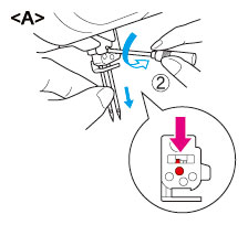 Removing the left needle