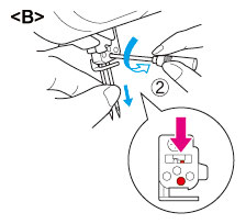 Removing the right needle